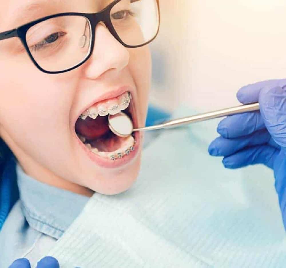 How Often Should You Do Dental Cleaning: The Ultimate Guide