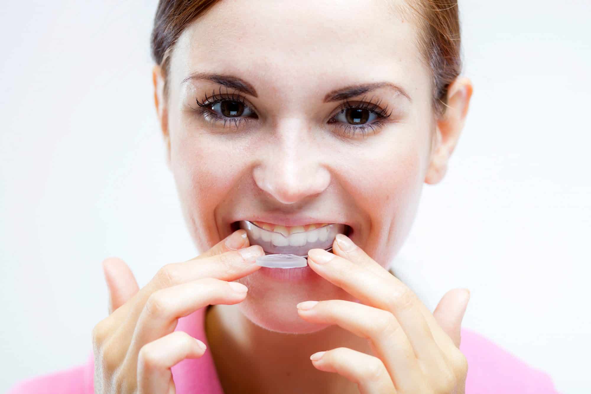 Mouth Guards Everything You Need to Know Prairie Pines Dental Centre