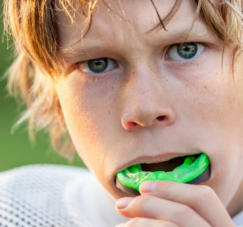 mouth guards in Prince Albert