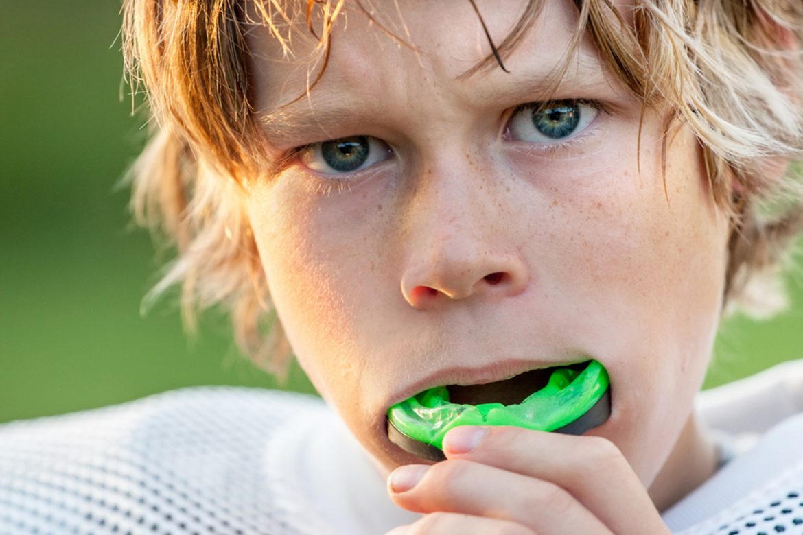 mouth guards in Prince Albert