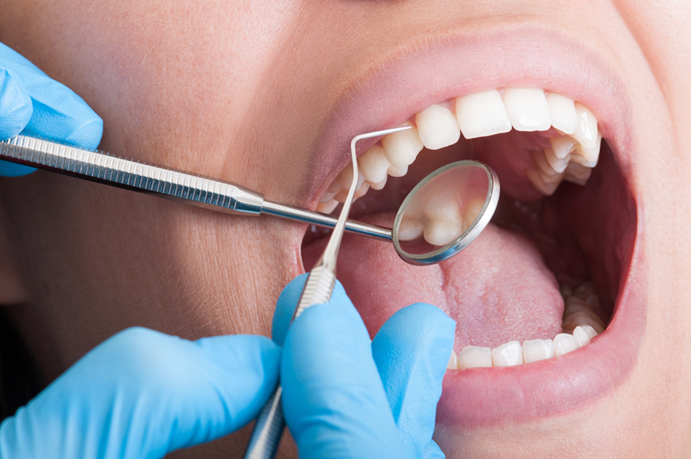 root canal therapy in Prince Albert