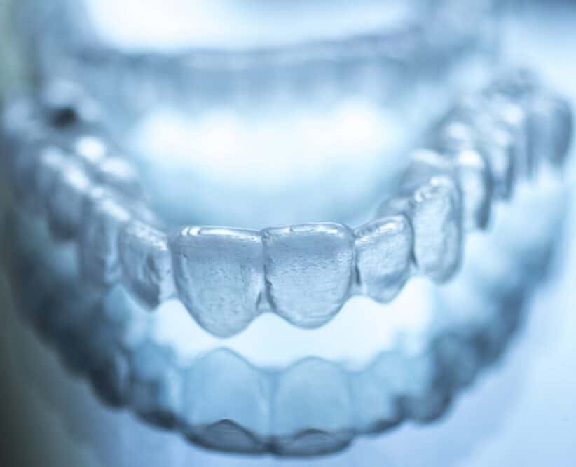 Invisalign clear aligners