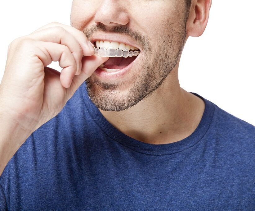 man wearing Invisalign