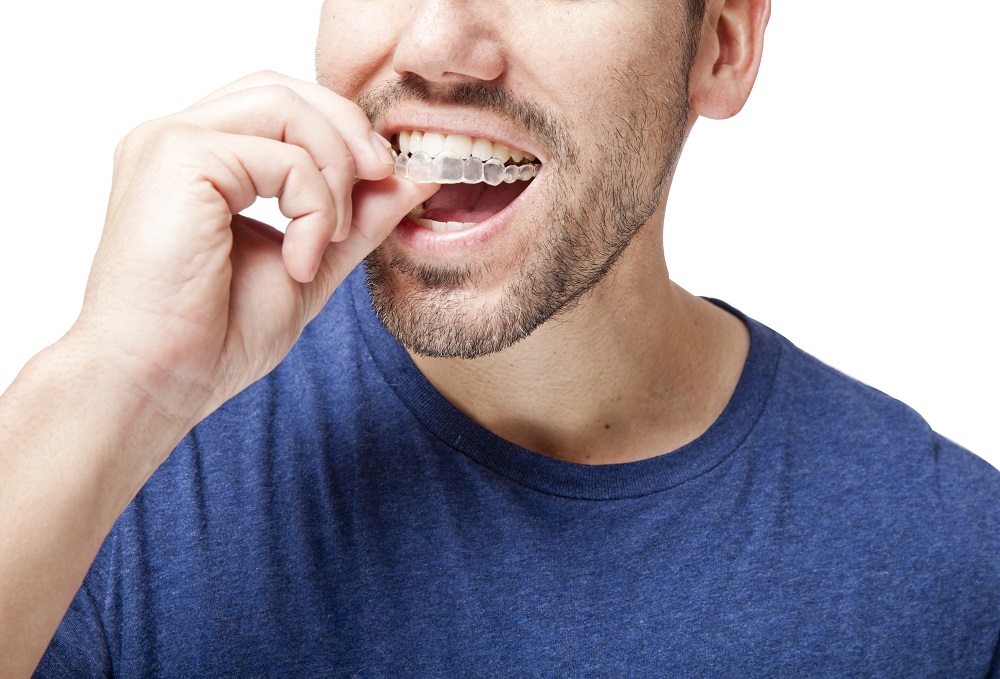 man wearing Invisalign