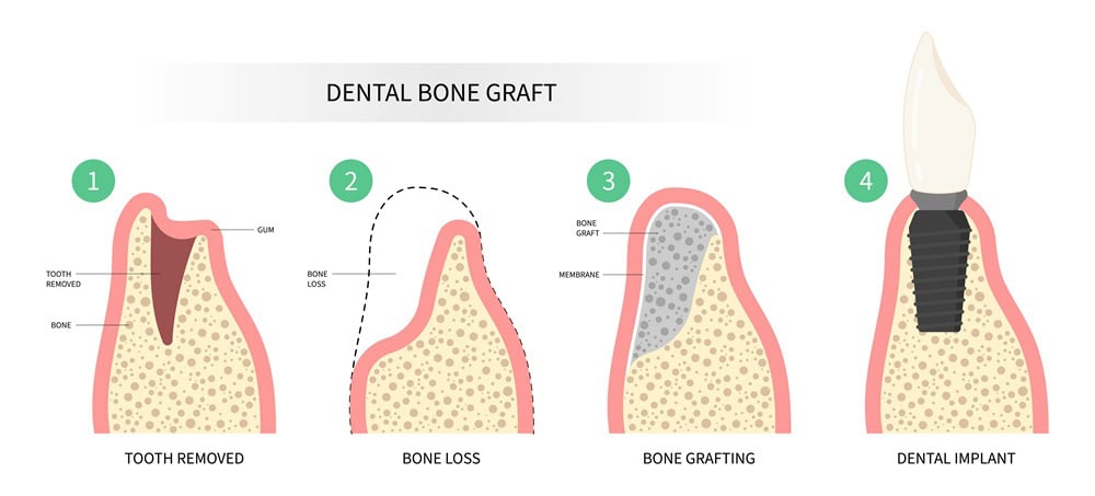 dentures near me