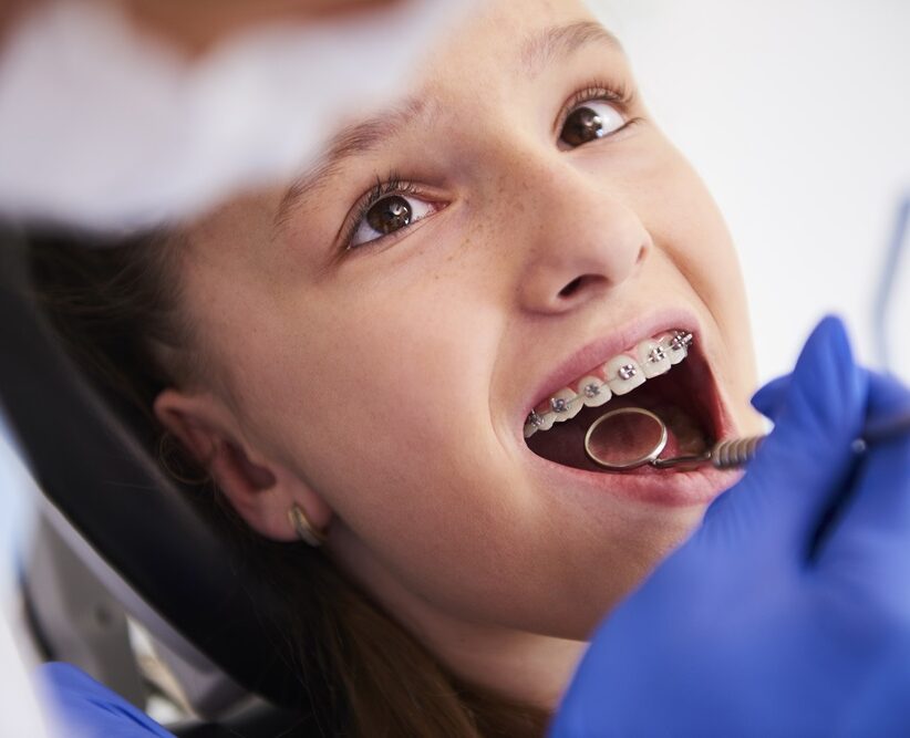woman taking orthodontic treatment