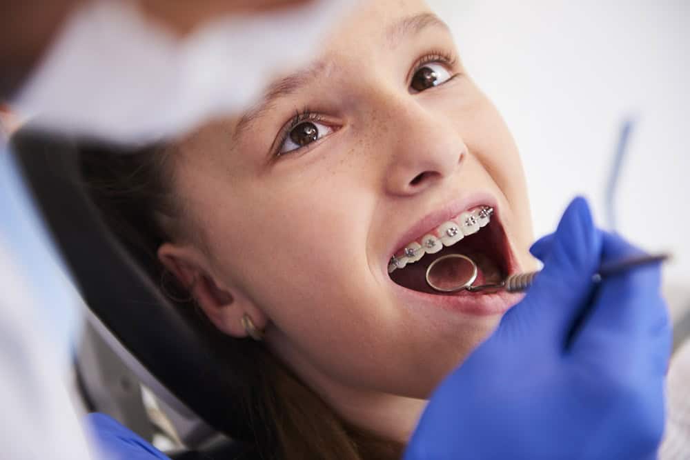 woman taking orthodontic treatment