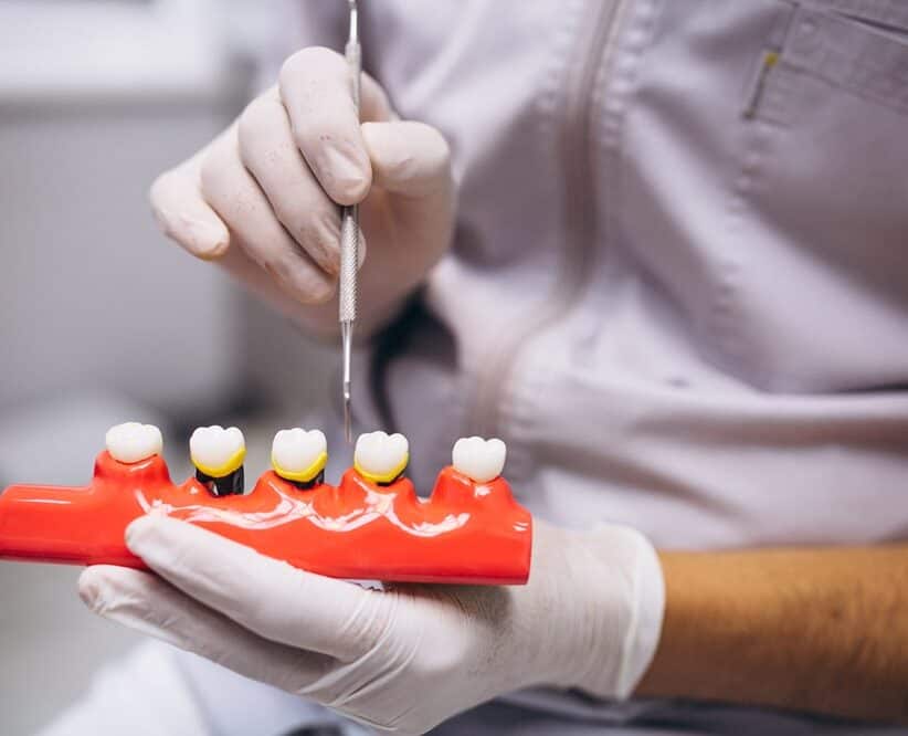 dentist explaining about tooth extraction