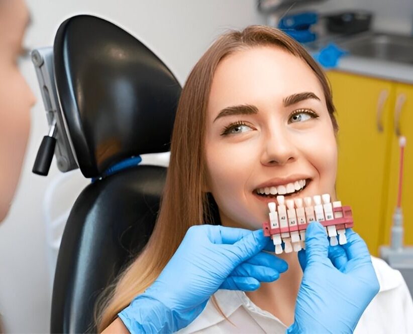 Porcelain Veneers in Prince Albert