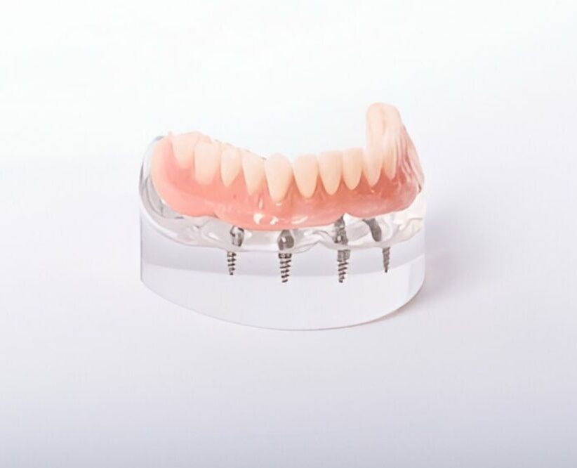 how dentures affect your taste buds