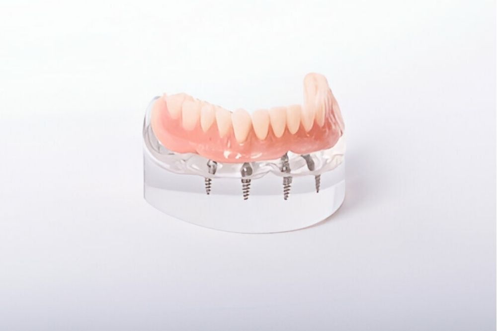 how dentures affect your taste buds