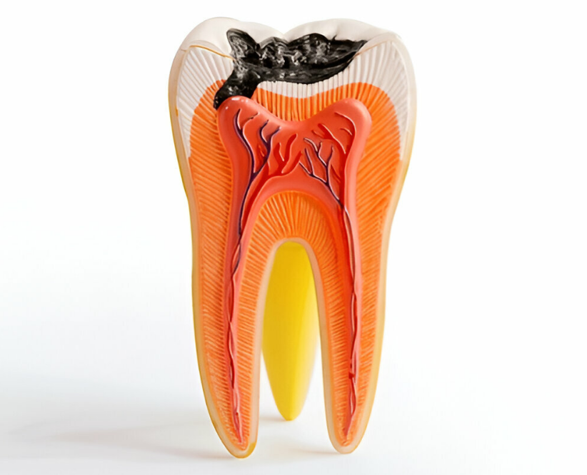 Root Canal Therapy in Prince Albert Best Oral Hygiene Tips