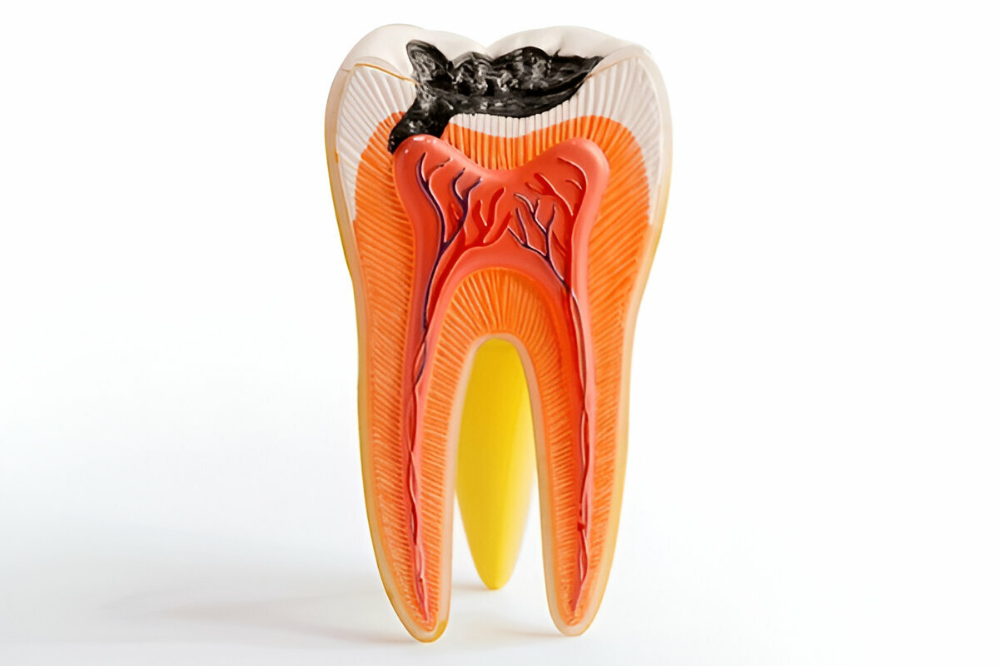 Root Canal Therapy in Prince Albert Best Oral Hygiene Tips
