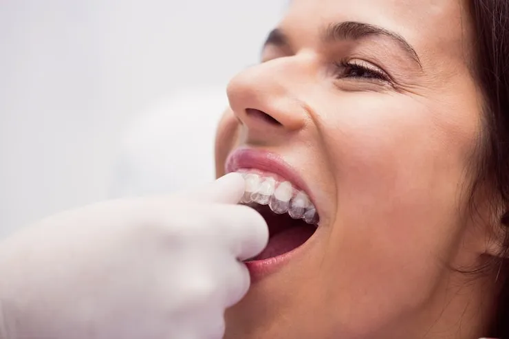 what are the benefits of wearing a mouth guard